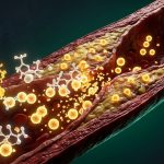 ApoB & Cardiovascular Biomarker Protocols in 2026: Citrus Bergamot, Kyolic Garlic & Plant Sterols Clinical Audit