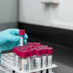 HOMA-IR & Fasting Insulin: True Metabolic Lab Ranges