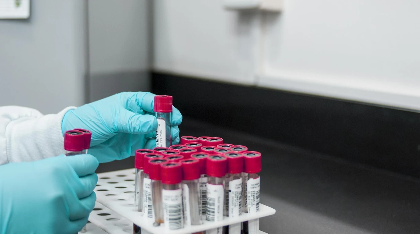 HOMA-IR and Fasting Insulin Metabolic Bloodwork Testing Laboratory Reference Ranges